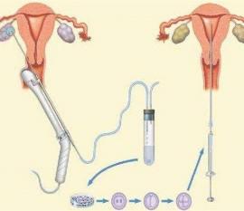 35岁女性备孕请做好以下检查，“健康嘉兴代生宝宝”跑不远